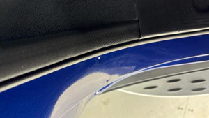 Dents