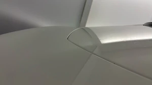 dent
