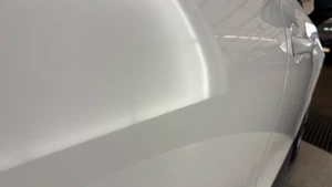 Dents